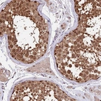 Anti-HERPUD1 Antibody
