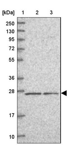 Lane 1: Marker [kDa] 250, 130, 95, 72, 55, 36, 28, 17, 10_br/_Lane 2: Human cell line RT-4_br/_Lane 3: Human cell line U-251MG sp