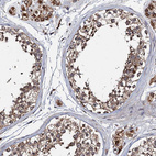 Immunohistochemical staining of human testis shows strong cytoplasmic positivity in cells in seminiferous ducts and Leydig cells.