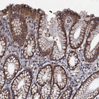 Immunohistochemical staining of human stomach shows strong cytoplasmic positivity in glandular cells.