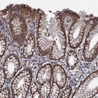 Immunohistochemical staining of human stomach shows strong cytoplasmic positivity in glandular cells.