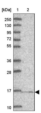 Lane 1: Marker [kDa] 250, 130, 95, 72, 55, 36, 28, 17, 10_br/_Lane 2: Human cell line RT-4