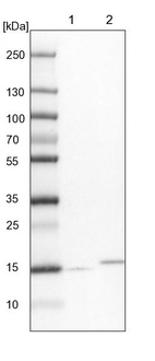 Lane 1: NIH-3T3 cell lysate (Mouse embryonic fibroblast cells)_br/_Lane 2: NBT-II cell lysate (Rat Wistar bladder tumour cells)