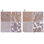 Anti-STUB1 Antibody