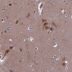 Immunohistochemical staining of human cerebral cortex shows moderate membranous/cytoplasmic positivity in neurons and neuropil.
