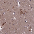 Immunohistochemical staining of human cerebral cortex shows moderate membranous/cytoplasmic positivity in neurons and neuropil.