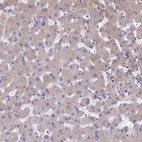 Immunohistochemical staining of human liver shows weak membranous positivity in hepatocytes.