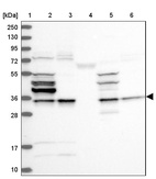 Anti-STUB1 Antibody