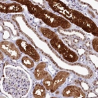 Anti-AHCY Antibody