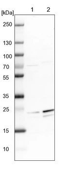 Lane 1: NIH-3T3 cell lysate (Mouse embryonic fibroblast cells)_br/_Lane 2: NBT-II cell lysate (Rat Wistar bladder tumour cells)