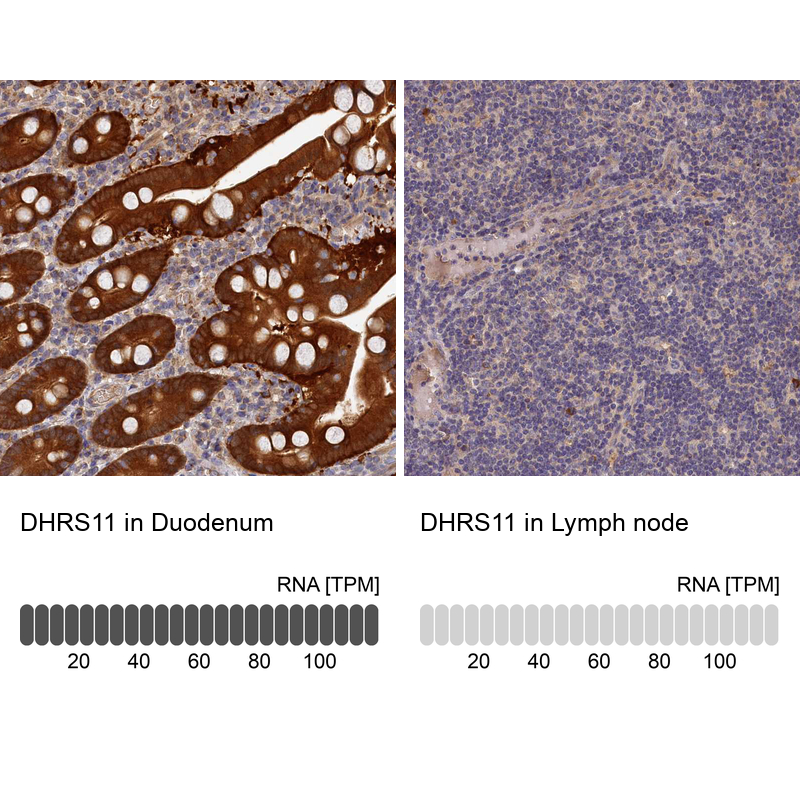 Anti-DHRS11 Antibody