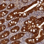 Immunohistochemical staining of human duodenum shows strong cytoplasmic positivity in glandular cells.
