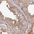 Immunohistochemical staining of human testis shows weak cytoplasmic positivity in cells in seminiferous ducts.