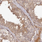 Immunohistochemical staining of human testis shows weak cytoplasmic positivity in cells in seminiferous ducts.