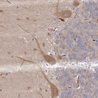 Immunohistochemical staining of human cerebellum shows moderate cytoplasmic positivity in Purkinje cells.