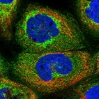 Immunofluorescent staining of human cell line A-431 shows localization to cytosol & the Golgi apparatus.