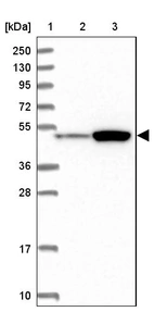 Lane 1: Marker [kDa] 250, 130, 95, 72, 55, 36, 28, 17, 10_br/_Lane 2: Human cell line RT-4_br/_Lane 3: Human cell line U-251MG sp