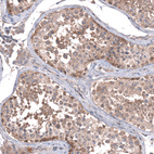 Anti-ZSWIM8 Antibody