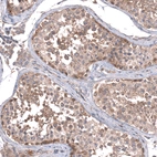 Anti-ZSWIM8 Antibody