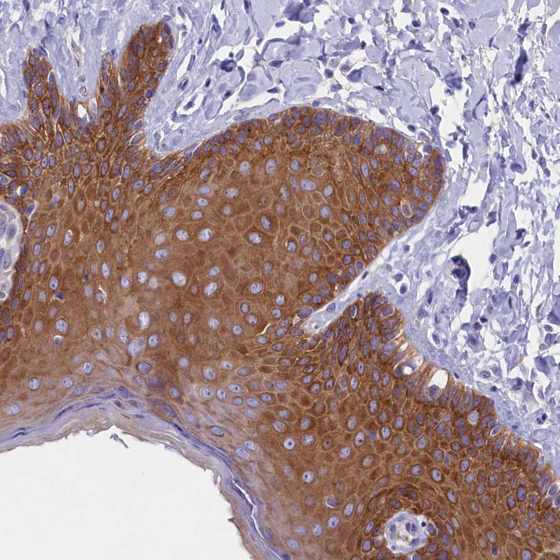Anti-PPP1R13L Antibody