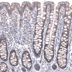Immunohistochemical staining of human rectum shows moderate cytoplasmic/cytoplasmic-membranous positivity in glandular cells.
