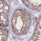 Immunohistochemical staining of human testis shows moderate cytoplasmic positivity in cells in seminiferous ducts.