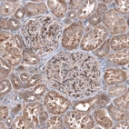 Immunohistochemical staining of human kidney shows moderate cytoplasmic/cytoplasmic-membranous positivity in cells in tubules and cells in glomeruli.