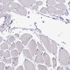 Immunohistochemical staining of human skeletal muscle shows no positivity in myocytes as expected.