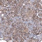 Immunohistochemical staining of human pancreas shows moderate cytoplasmic/cytoplasmic-membranous positivity in exocrine glandular cells.