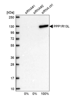 Western blot analysis in U2OS cells transfected with control siRNA, target specific siRNA probe #1 and #2, using Anti-PPP1R13L antibody. Remaining relative intensity is presented.