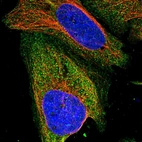 Immunofluorescent staining of human cell line U-2 OS shows localization to plasma membrane & cytosol.