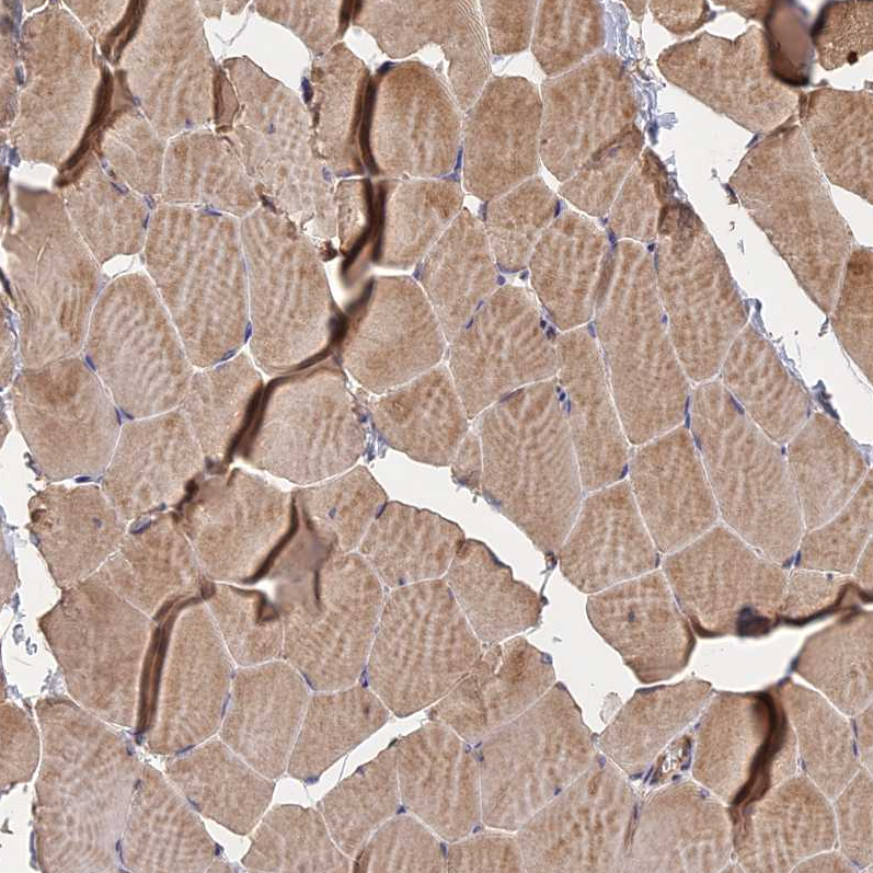 Anti-NUDT8 Antibody