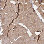 Anti-NUDT8 Antibody