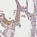 Anti-OAS3 Antibody