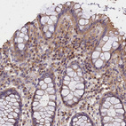 Immunohistochemical staining of human rectum shows moderate cytoplasmic positivity in lymphoid cells.