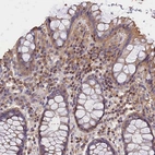 Immunohistochemical staining of human rectum shows moderate cytoplasmic positivity in lymphoid cells.