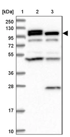 Lane 1: Marker [kDa] 250, 130, 95, 72, 55, 36, 28, 17, 10_br/_Lane 2: Human cell line RT-4_br/_Lane 3: Human cell line U-251MG sp