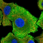 Immunofluorescent staining of human cell line A549 shows localization to plasma membrane & cytosol.
