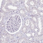 Immunohistochemical staining of human kidney shows low expression as expected.