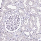 Immunohistochemical staining of human kidney shows low expression as expected.