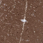 Anti-CBLN3 Antibody