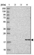 Lane 1: Marker [kDa] 250, 130, 95, 72, 55, 36, 28, 17, 10_br/_Lane 2: Human cell line RT-4_br/_Lane 3: Human cell line U-251MG sp_br/_Lane 4: Human plasma (IgG/HSA depleted)