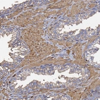 Immunohistochemical staining of human prostate shows moderate positivity in smooth muscle cells.