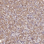 Immunohistochemical staining of human stomach shows moderate membranous positivity.