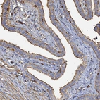 Immunohistochemical staining of human fallopian tube shows moderate positivity in glandular cells.