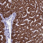 Anti-ANKRD29 Antibody