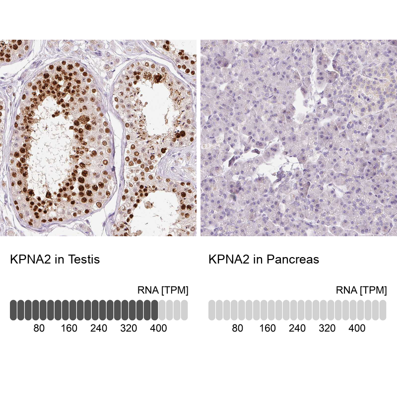Anti-KPNA2 Antibody