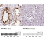 Anti-KPNA2 Antibody