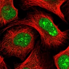 Anti-KANSL3 Antibody