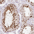 Immunohistochemical staining of human testis shows strong nuclear positivity in cells in seminiferous ducts.